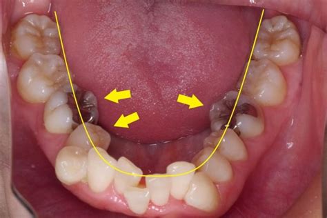 フェラで歯が当たる方へ、フェラが上達する方法を解。